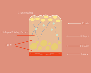3 Bio Regenerative Treatments that Build Collagen
