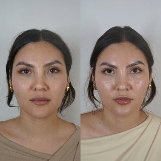 SkinVive + FREE Smooth Threads